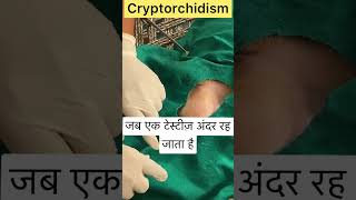 Cryptorchidism l Dr Umar Khan [upl. by Assenav639]