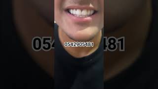 Snap on smile tiktokvideo dz algerie [upl. by Othello]