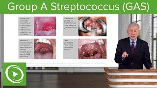 Group A Streptococcus GAS – Infectious Diseases  Lecturio [upl. by Dante127]