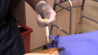 Live Intraarticular Hip Injection with a Hip Replacement [upl. by Ailedua]