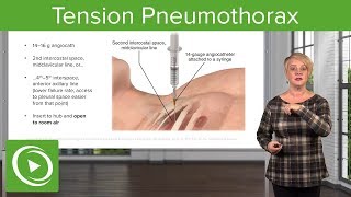 🚨 Tension Pneumothorax Critical Diagnosis amp Treatment Explained [upl. by Jordanson]