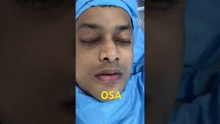 Best OSA Snoring Corrective Surgery for this physician patient from Singapore [upl. by Akirdnahs79]