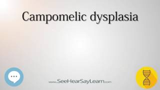 Campomelic dysplasia 🔊 [upl. by Schilling821]