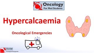 Hypercalcaemia of malignancy [upl. by Huntingdon]