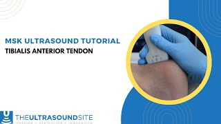 MSK ultrasound of the tibialis anterior tendon [upl. by Grenier]