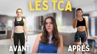 mon histoire avec les TCA [upl. by Renruojos]