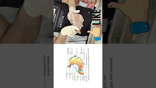 Prepyloric vein of Mayo Embryological Significance of prepyloric vein of Mayo shorts anatomy [upl. by Itnuahsa]