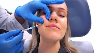 SCULPTRA filler for the first time OMG [upl. by Reede]