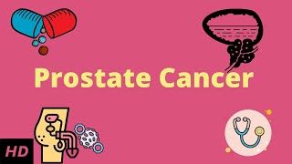 Prostrate Cancer Causes Signs and Symptoms DIagnosis and Treatment [upl. by Luapnhoj]