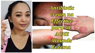 Antibiotic Cream na Effective treatment  Para sa Wounds ACNE at Eczema [upl. by Theodosia]