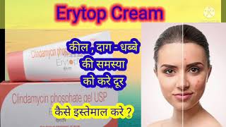 Erytop Cream review in hindi  Uses  कील दाग और धब्बे की समस्या को करे दुर [upl. by Ttiwed]