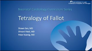 Tetralogy of Fallot [upl. by Auqkinahs686]