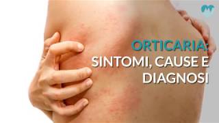 Orticaria sintomi cause e diagnosi [upl. by Nnylannej776]