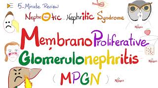 Membranoproliferative Glomerulonephritis Type 1 and 2  MPGNI amp MPGNII  Nephrology [upl. by Radek666]