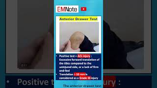 Anterior Drawer Test Knee ACL Injury doctor nursing [upl. by Page344]