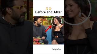 Nimrat kaur Before amp after lip filler💋 shorts ytshortsyoutubeshorts abhishekbachchan nimratkaur [upl. by Lattie]