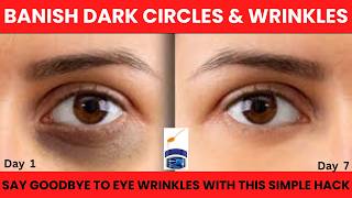 Vaseline amp Turmeric for Dark Circles amp Eye Wrinkles Does It Work [upl. by Swaine]