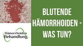 Blutende Hämorrhoiden  Was kann man tun wenn die Hämorrhoiden bluten [upl. by Enytsirhc]