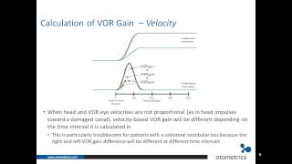 ICS Impulse vHIT Interpretation of test results [upl. by Hyacinthia]