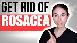 How To Get Rid Of Rosacea  Dermatologist Tips [upl. by Orpah]