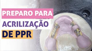 PREPARO PARA ACRILIZAÇÃO PPR  Beatriz Vieira [upl. by Eugenle160]