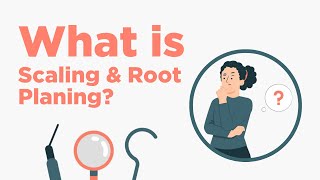 Scaling amp Root Planing  Everything You Need to Know [upl. by Brodie]