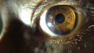 Pupil Dilating eye changing apeture HD [upl. by Ayatal336]