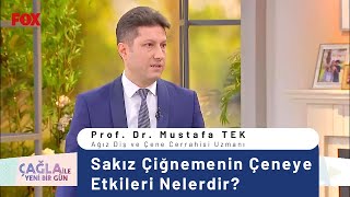 Sakız Çiğnemenin Çeneye Etkileri Nelerdir [upl. by Suoicul]