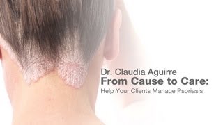 From Cause to Care Help your clients manage psoriasis [upl. by Ellednek]