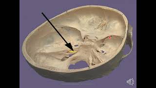 Cranial cavity part 1  ProfDr Manal Elsawaf [upl. by Trebor806]