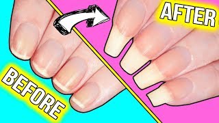 How to GROW YOUR NAILS FAST actually helpful information [upl. by Llezniuq399]