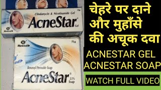 ACNESTAR GEL AND ACNESTAR SOAP REVIEW II ACNE PIMPLE CREAM AND ACNE PIMPLE SOAP [upl. by Alyakim]