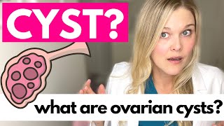 OVARIAN CYSTS What Causes Ovarian Cysts [upl. by Laughlin704]