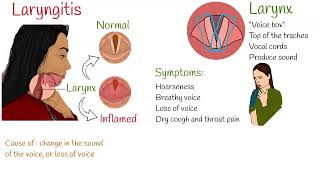 Laryngitis  Symptoms causes and treatment [upl. by Ingar]