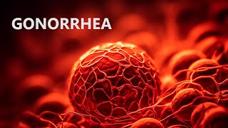 ගොනෝරියා 😨 Gonorrhea  Symptoms  Causes  Treatment in sinhala  lingika roga [upl. by Otilopih]