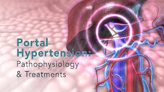 PORTAL HYPERTENSION Pathophysiology and Common Treatments [upl. by Irrab366]