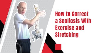 How to Correct a Scoliosis With Exercise and Stretching  Ed Paget [upl. by Ardnoek245]