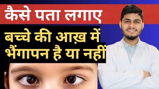 How to Check Squint At Home  Best exercise For Squint Eye  Strabismus [upl. by Ahseer]