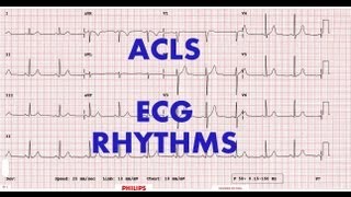 ACLS  ECG rhythm recognition amp management Part 1 [upl. by Sully]