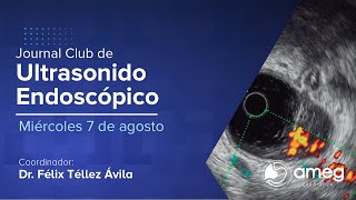 Journal Club Ultrasonido Endoscópico  7 de agosto 2024 [upl. by Molli]