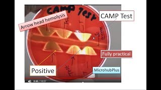 CAMP test CAMP Factor  CAMP Reaction  Microbiology Streptococcus agalactiae [upl. by Atsyrc404]