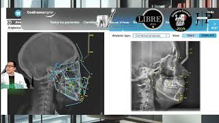 Ceph assistant para cefalometría con IA de cedirama [upl. by Eiduam]
