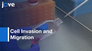 Scratch Wound Assay and Boyden Chamber Assay Comparison  Protocol Preview [upl. by Nemracledairam]