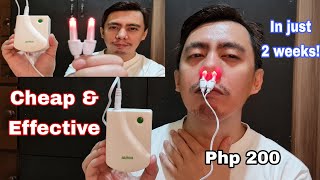 BIONASE RHINITIS SINUSITIS NOSE THERAPY LED LIGHT  ANG CHEAP  EFFECTIVE BA NURSE REAL TALK REVIEW [upl. by Nraa321]