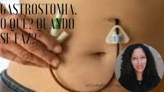 O QUE É GASTROSTOMIA [upl. by Kilk]