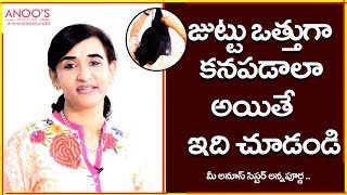 Easy Hair Tricks for Bald Hair at Home  Back Combing  Hairstyles – Anoos Annapurna [upl. by Sinai]