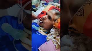 tracheostomy Patient 6 months condition [upl. by Gregorio500]