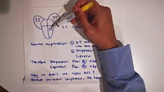 CONSTRICTIVE PERICARDITIS PART 1 [upl. by Assenyl]