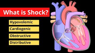 Shock Explained in 120 Seconds  Treatment Symptoms Causes  Video [upl. by Thomson719]