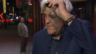 Jay Leno Gets Swollen Eye After Falling Down 60Foot Hill [upl. by Eveleen541]